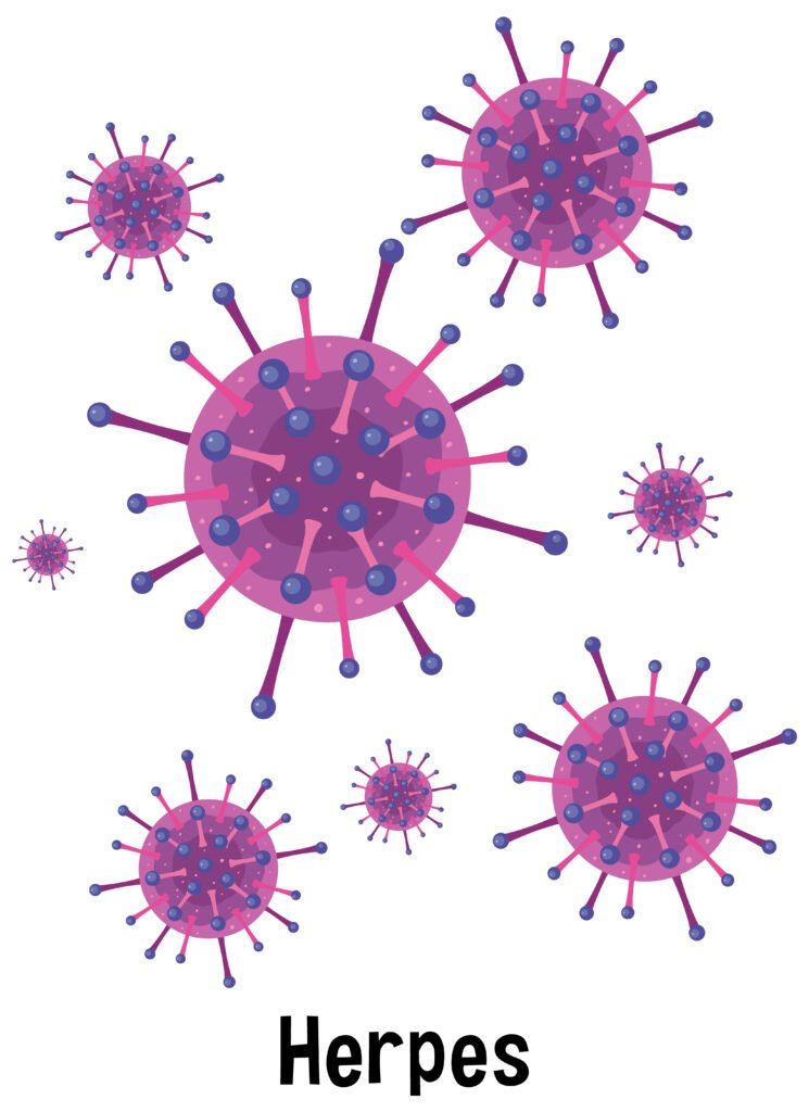 Herpes Cure