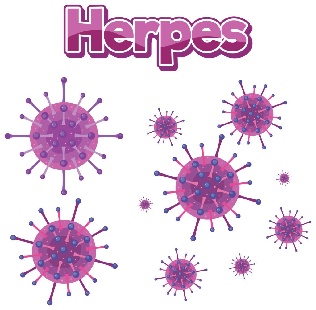 Herpes Cure
